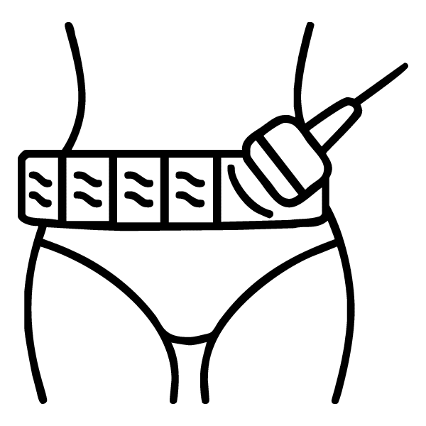 Criolipólise
