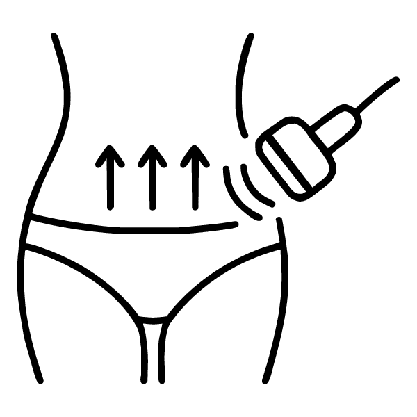 Lipocavitação