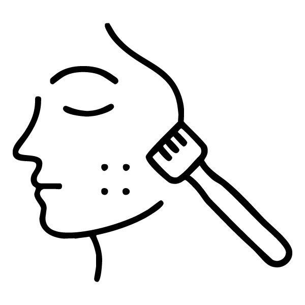 Microagulhamento